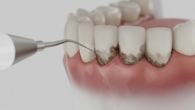 Reliable Dental contractor in Campbell, OH by Dentist Open Now